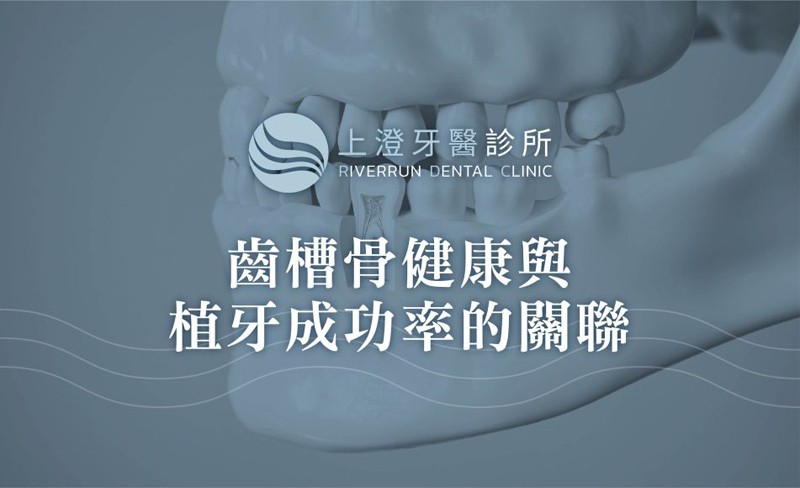 齒槽骨健康與植牙成功率的關聯