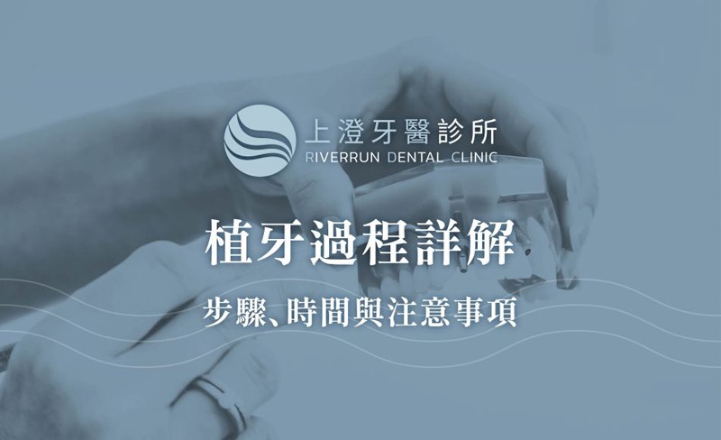 植牙過程詳解：步驟、時間與注意事項