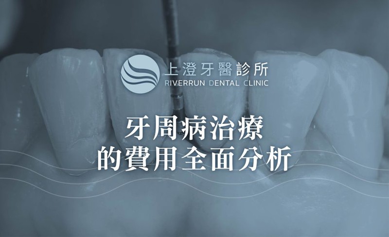 牙周病治療的費用全面分析