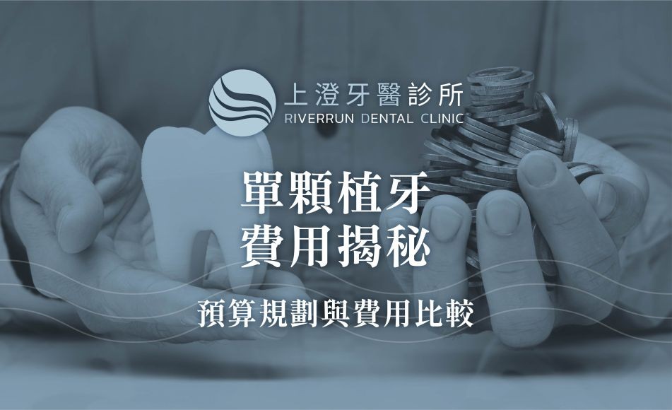 單顆植牙費用揭秘：預算規劃與費用比較