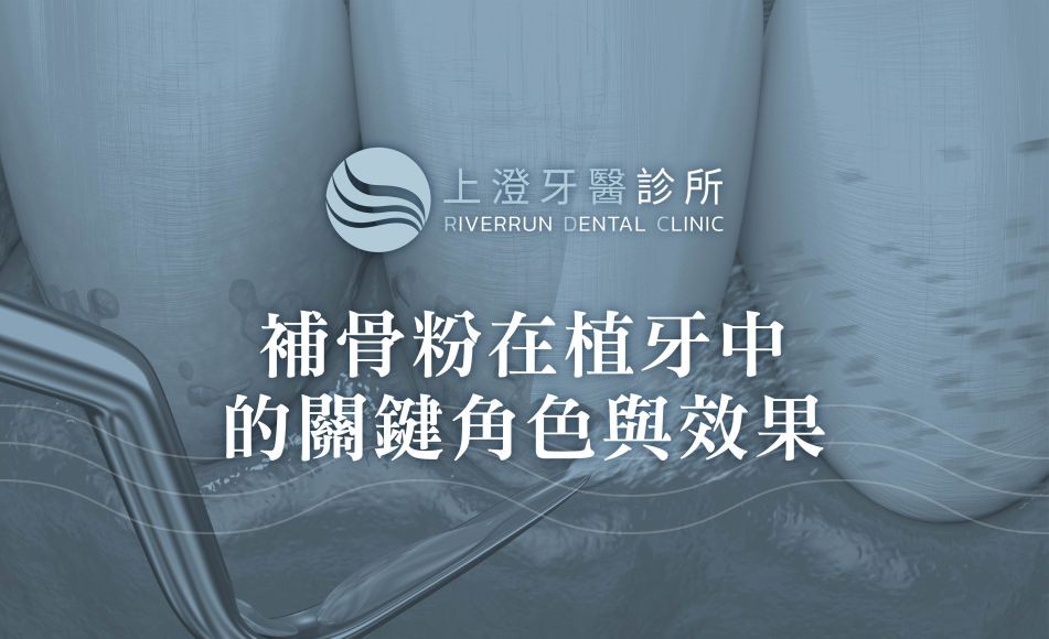 補骨粉在植牙中的關鍵角色與效果