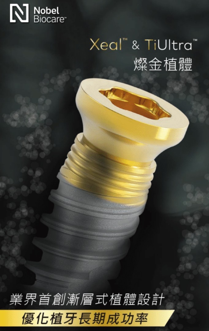 X-Guide導航植牙|讓植牙更精準、更安全的智慧科技 X-Guide導航植牙|讓植牙更精準、更安全的智慧科技