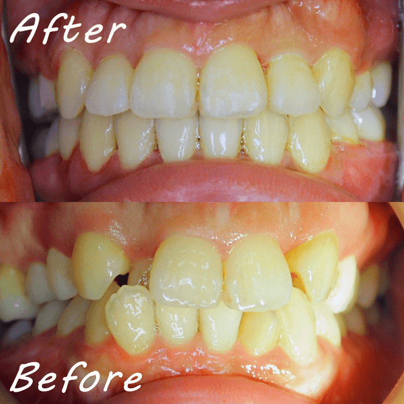 鄭士魁醫師【矯正專科醫師】兒童、青少年、成人全方位矯正